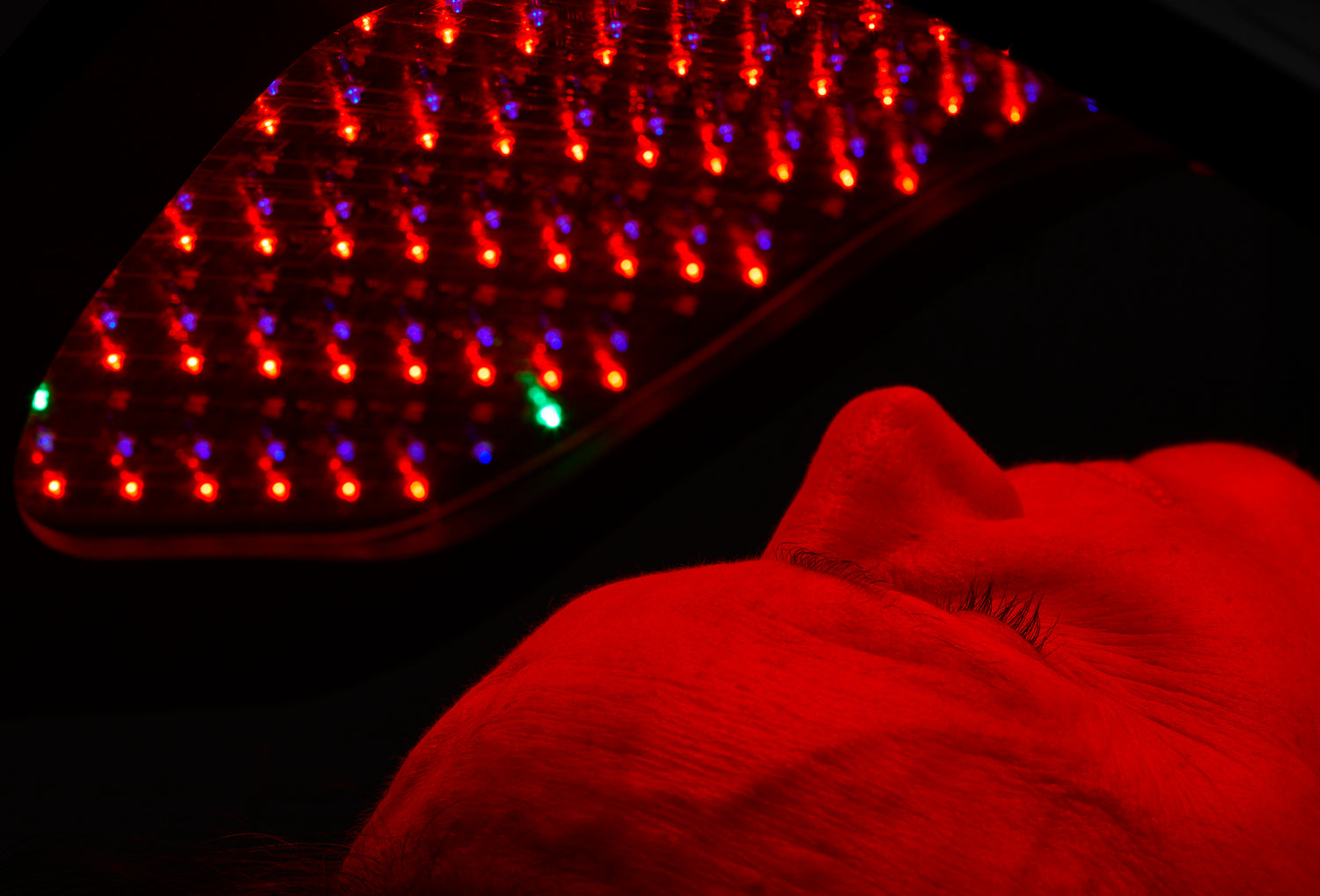 The face of a patient receiving red light treatment in a dark room. The red light panel is above her.