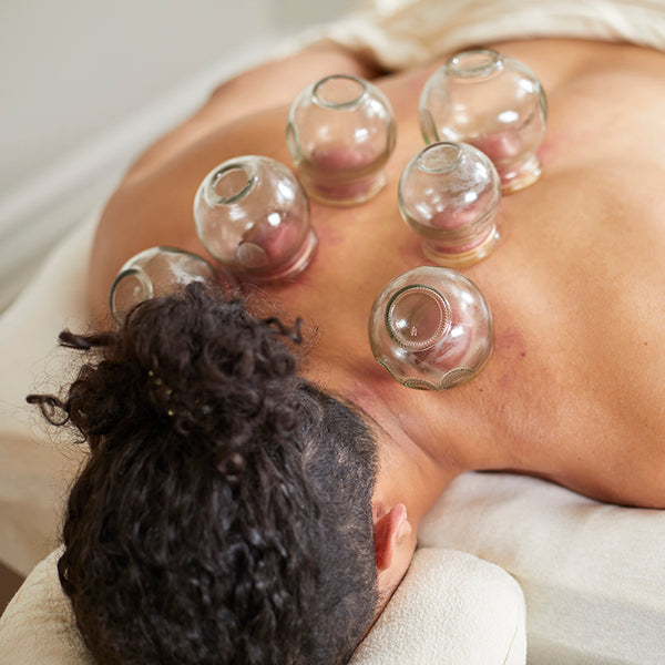 A patient receiving cupping in a treatment room, with glass cups on his upper back.