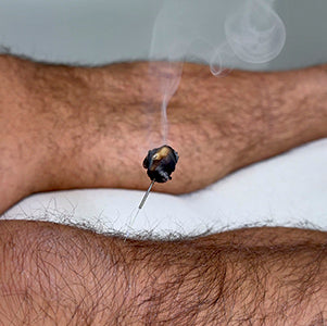 A patient receiving moxibustion -- a burning of dried mugwort aka moxa -- on his leg.